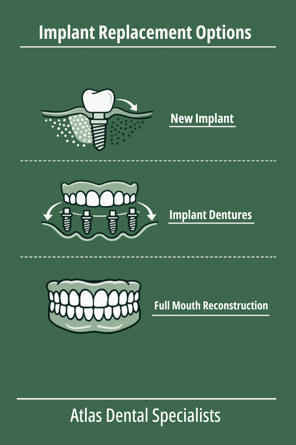 Inforgraphic Atlas Failed Dental Implant Heres What You Need to Know About Replacement Options - Atlas Dental Specialists