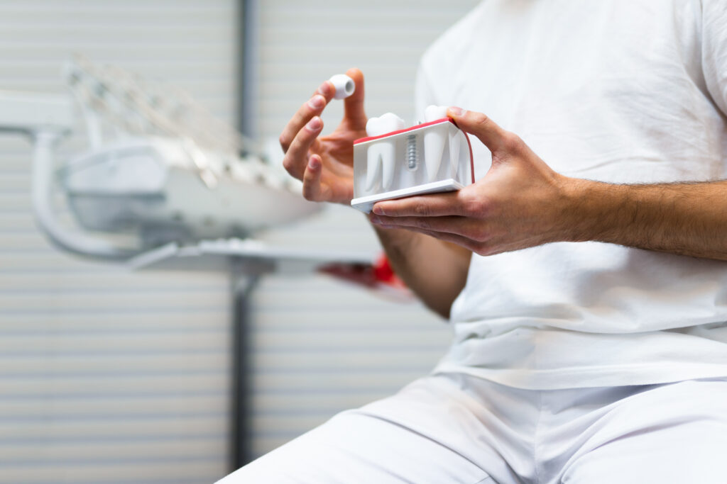 Dentist holding a full-arch dental implant model