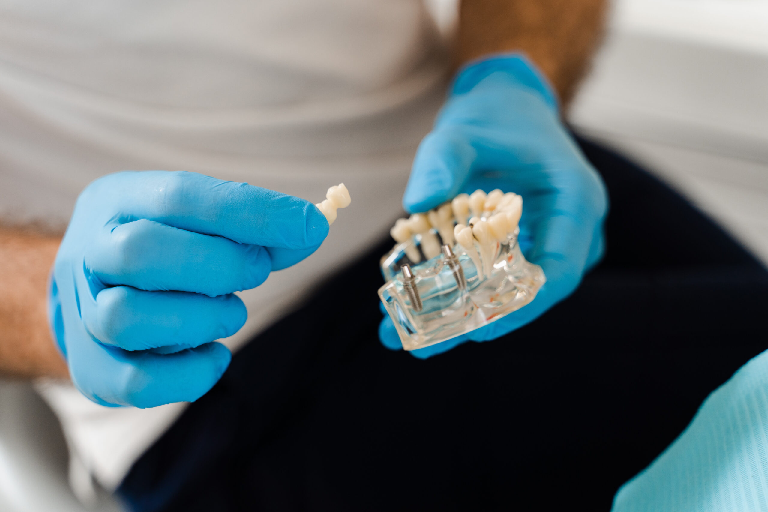 Close-up of a dental implant model showing the titanium post and crown placement in the jaw